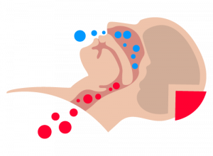 Apnea Mixta